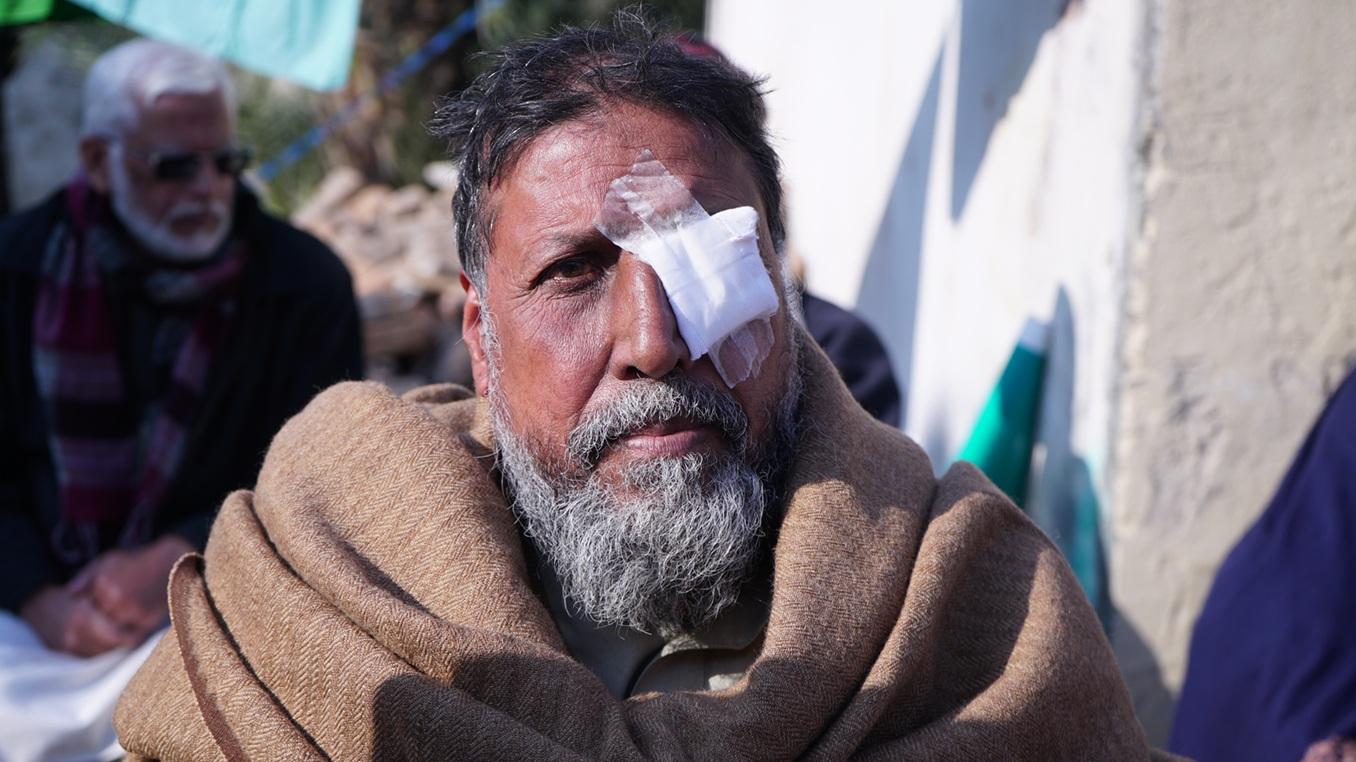 Sadaqah Jariyah cataract Surgery Sadaqah Jariyah cataract Surgery